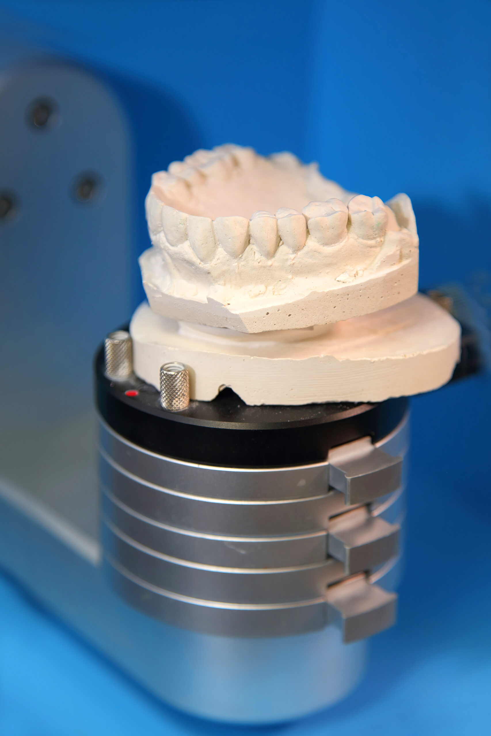 Ceramic dental crowns for implants. Fabrication of dental crowns and dentures made of ceramic. Scanning of plaster casts of teeth.